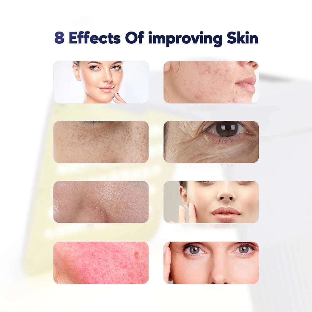 Foreverlily LED Photon Facial Beauty Machine For Home Skin Care