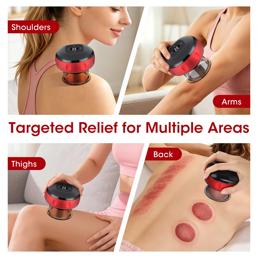 Pastsky Rechargeable Smart Cupping Device 12 Suction LCD Display